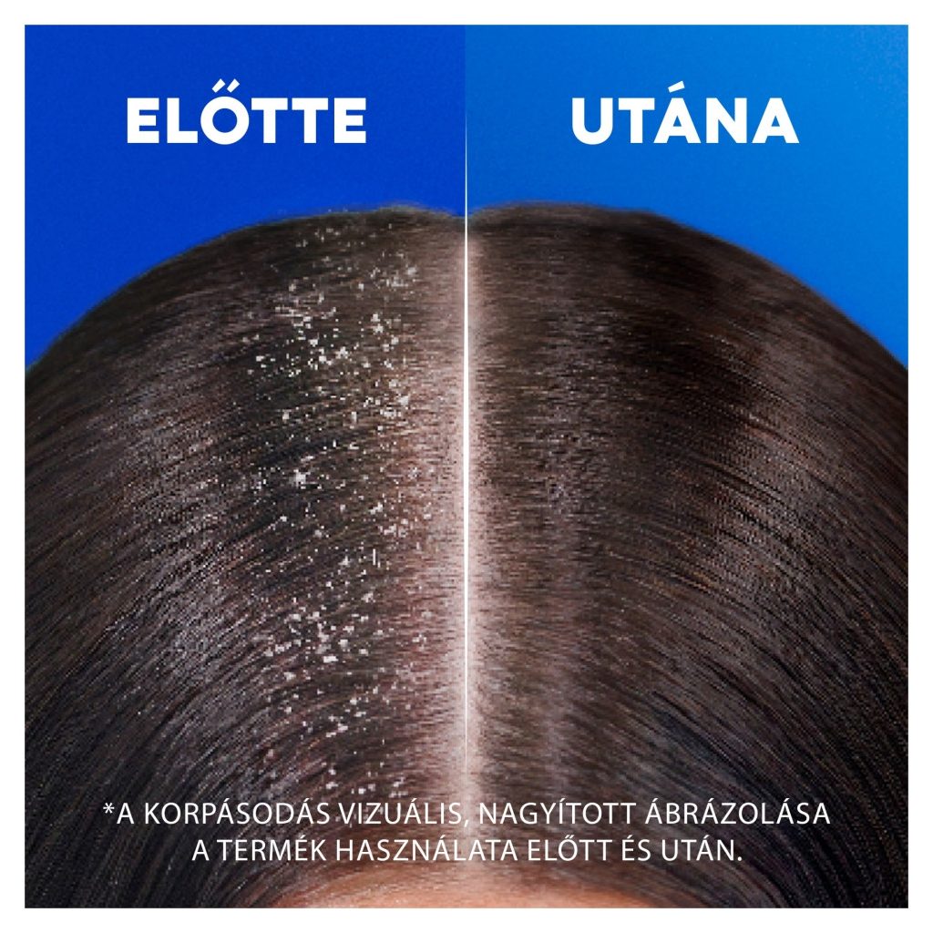 Head & Shoulders Mélyhidratáló korpásodás elleni Sampon 2x400 ml