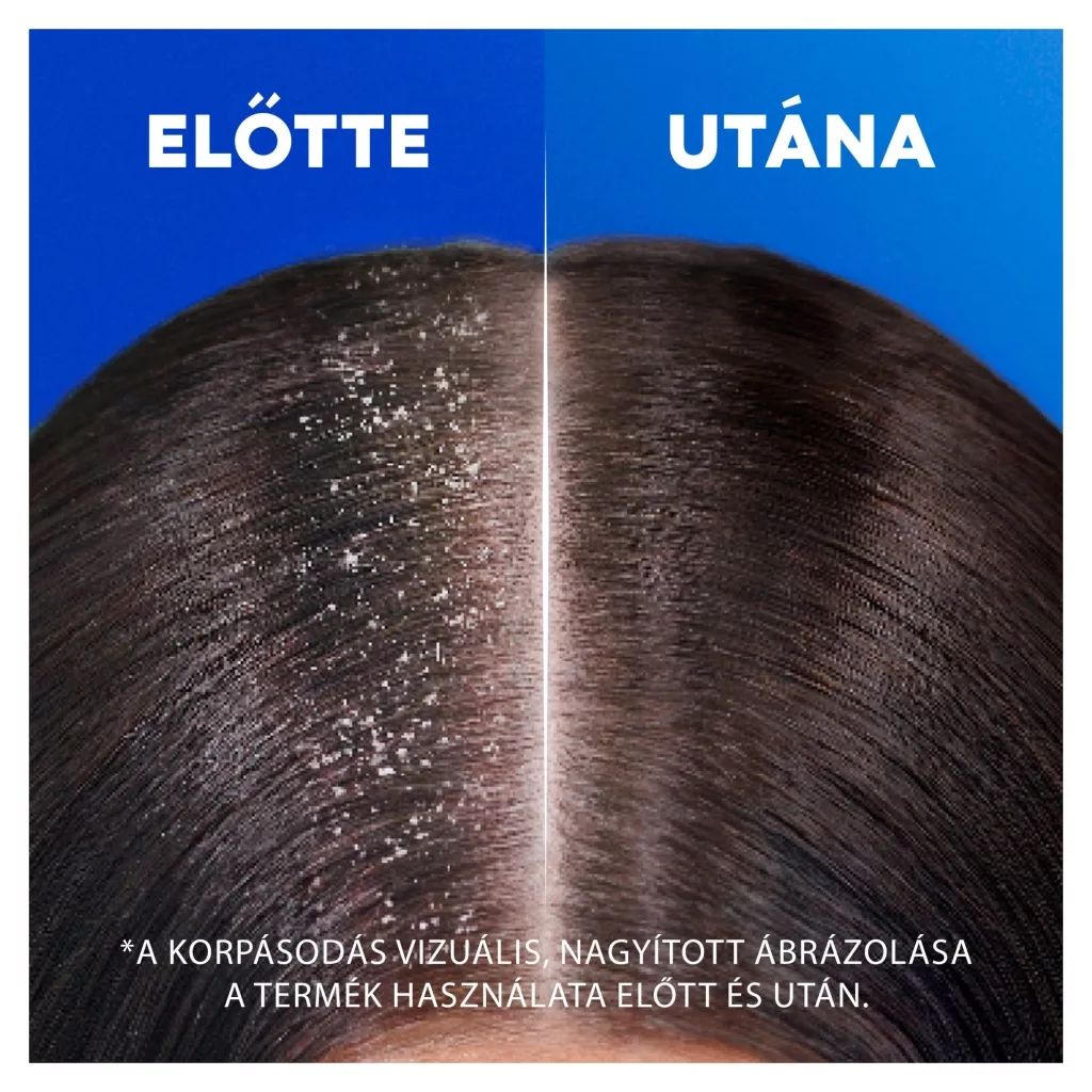 Head & Shoulders Classic Clean Sampon 2x400 ml