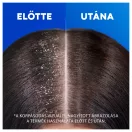 Head & Shoulders Classic Clean Sampon 2x400 ml