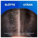 Head & Shoulders Classic Clean korpásodás elleni sampon (2x800 ml)