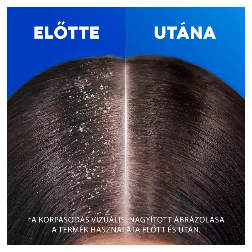 Head & Shoulders Classic Clean korpásodás elleni sampon (3x800 ml)