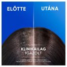 Head & Shoulders Classic Clean 2az1-ben korpásodás elleni sampon (2x330 ml)