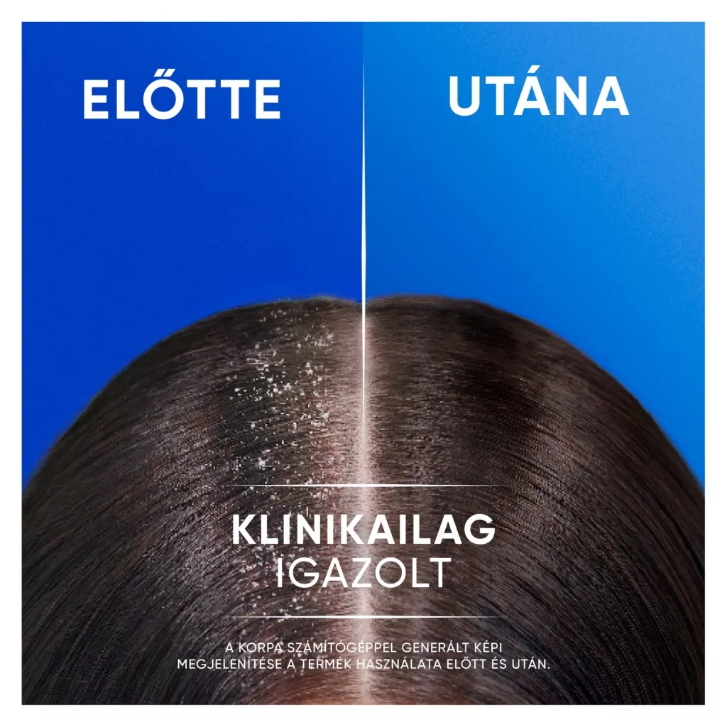 Head & Shoulders Classic Clean 2az1-ben korpásodás elleni sampon (625 ml)