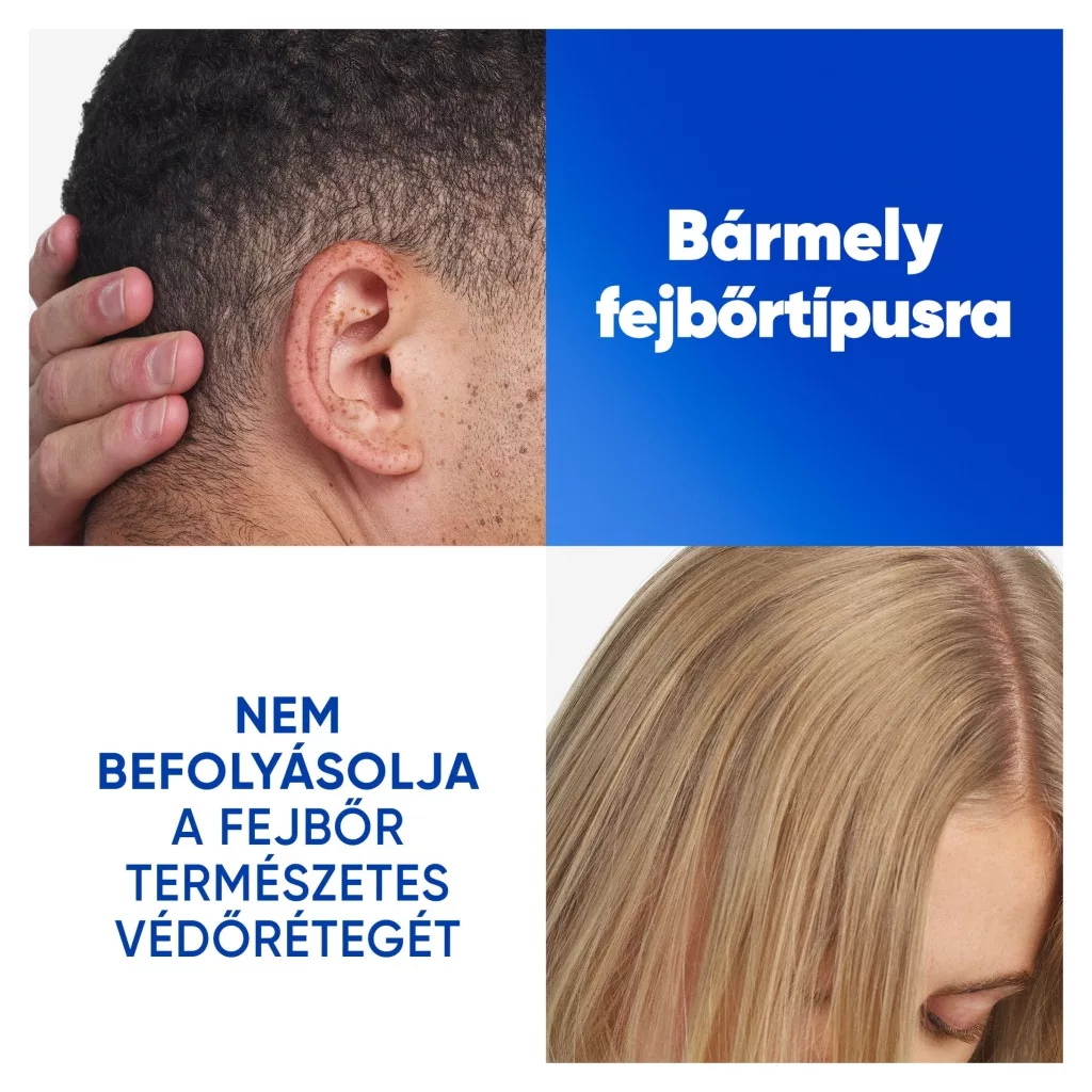 Head & Shoulders Menthol korpásodás elleni sampon (400 ml)