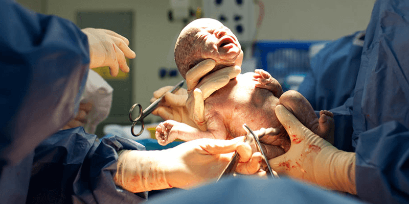 Amit még nem tudtál a szülésről...